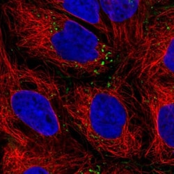 IQGAP2 Antibody, Novus Biologicals 0.1mL; Unlabeled:Antibodies, Polyclonal